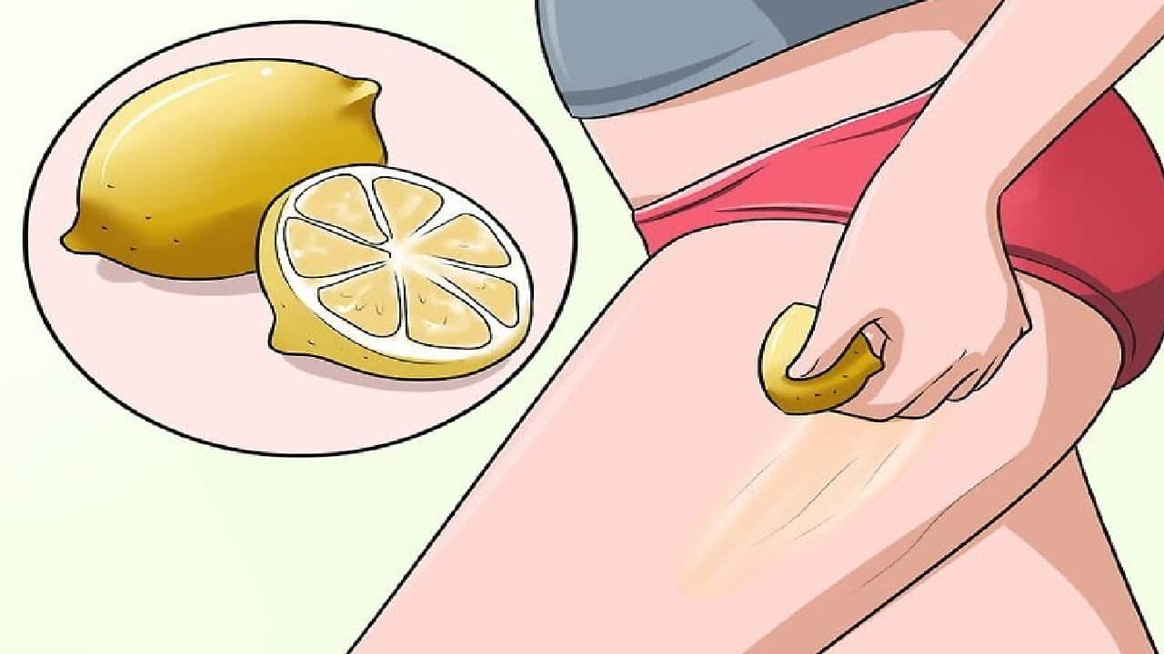 eliminar estrias con limon